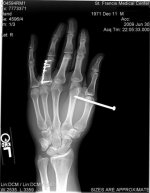 mrhand.jpg